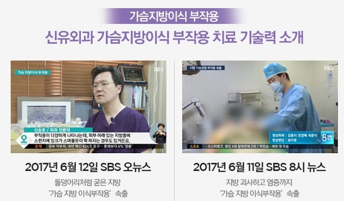 70E컵을 B컵으로 : 유방축소술 가슴축소수술 상담