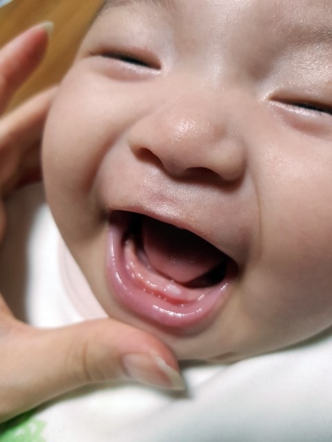  『신생아 이빨나는 시기! 나연이 100일전 첫니났어요』