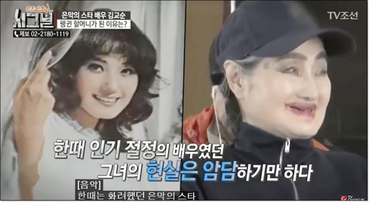  김교순 충격적인 얼굴,누가 이렇게 만들었나?