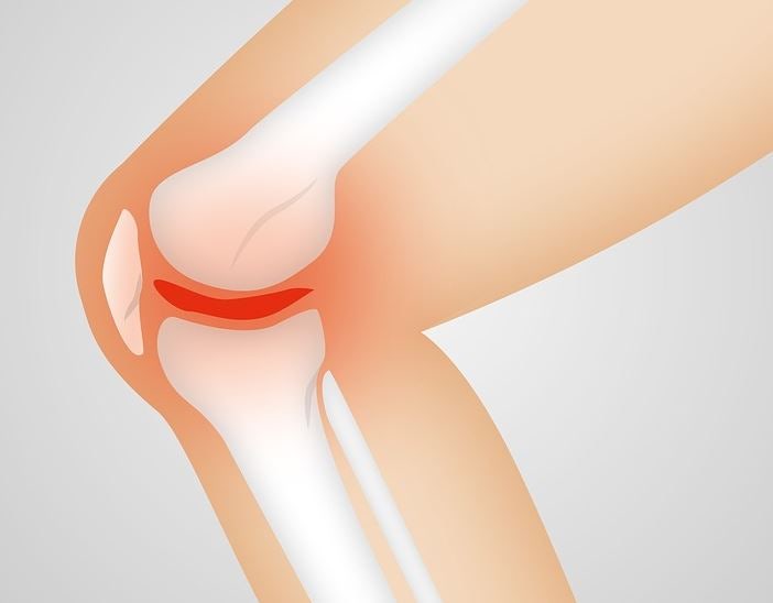 구로디지털단지 무릎수술 체중조절이 필요한 이유 1