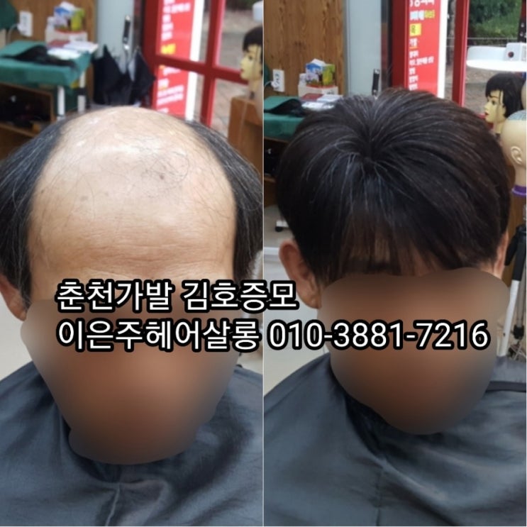  춘천가발 김호증모 가발관리잘하는곳 이은주헤어살롱에서 젊음찾기^^