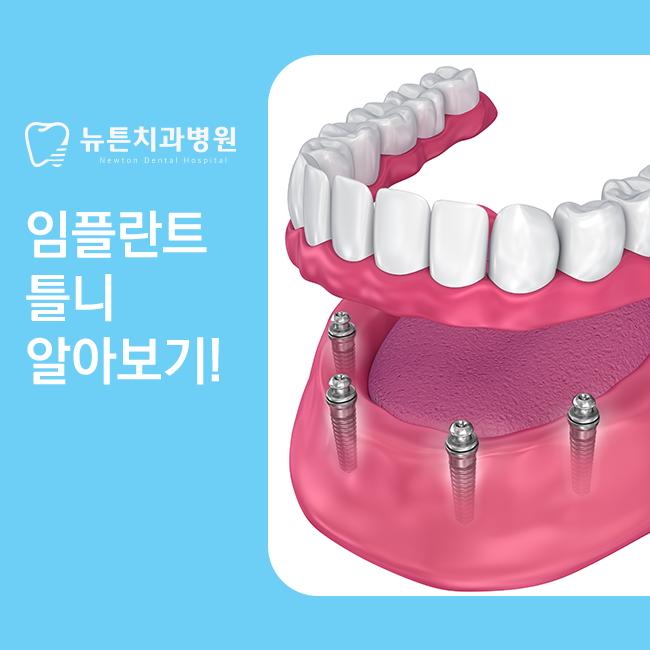 부산역치과 임플란트 주의사항이 궁금하시다면 2