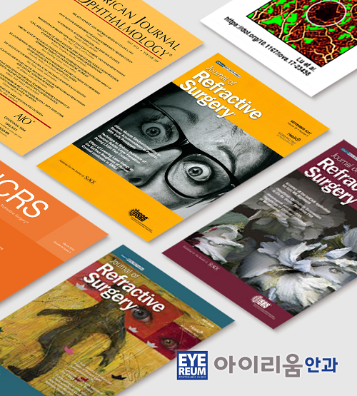 아이리움안과 로우에너지 스마일라식의 차별점