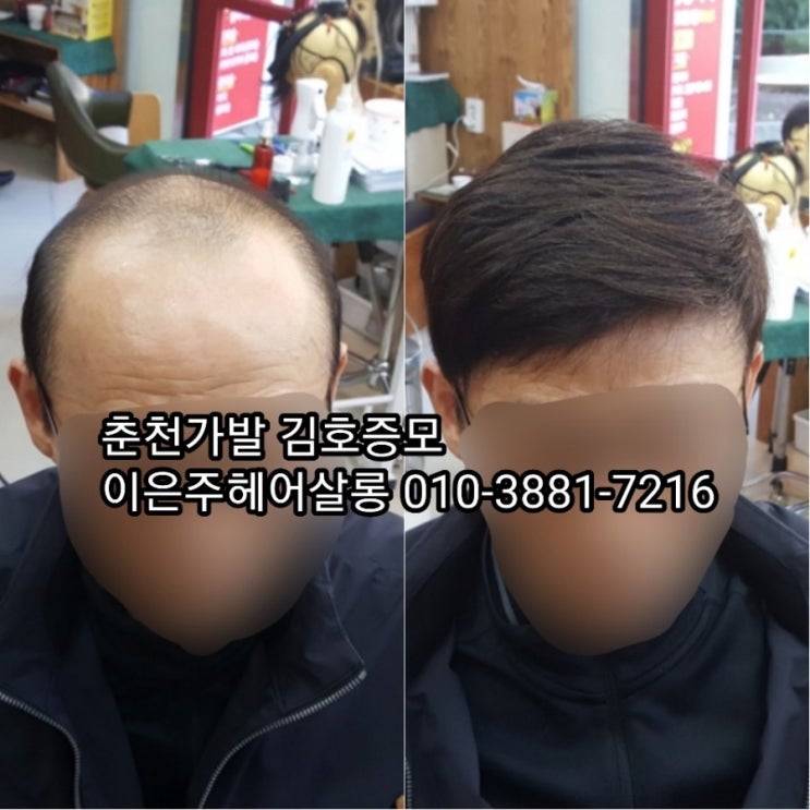 춘천가발 김호증모 남자맞춤가발 컷트 잘하네요~^^
