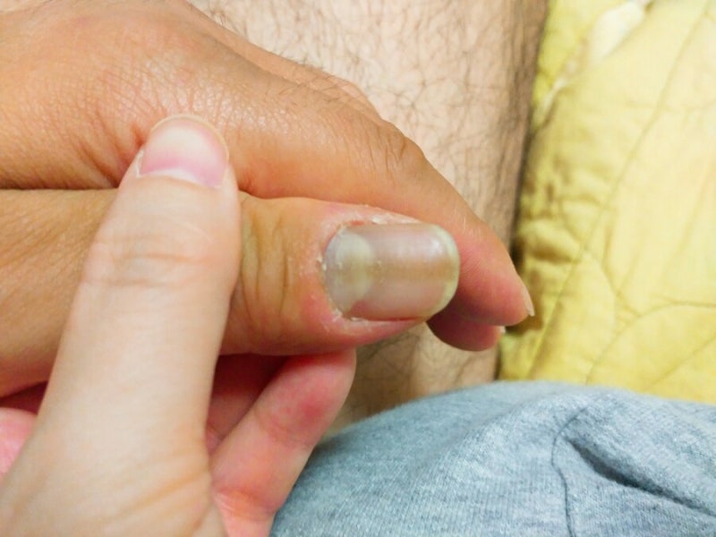 큐티클 네일 완벽밀착 골무팩 롭스에서 득템 네이버 블로그