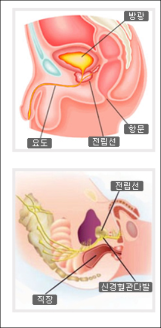 전립선비대증 퍼펙트비뇨기과의원 검사를 받아 보세요