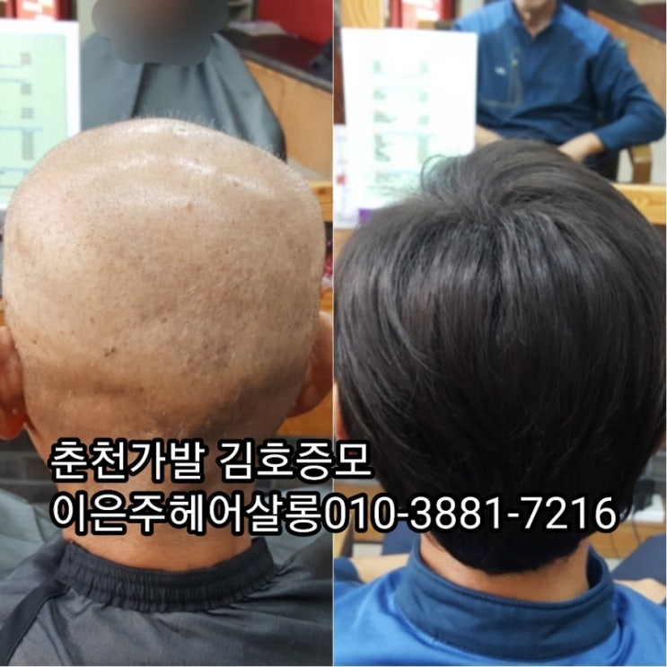  춘천가발 김호증모 항암가발 전체가발 패션가발 착한가격