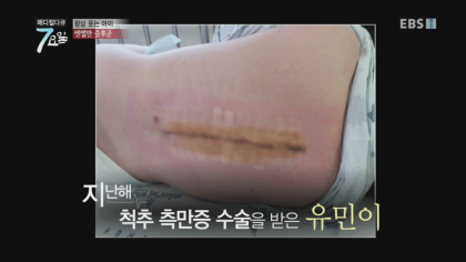 엔젤만 증후군을 앓고 있는 성인