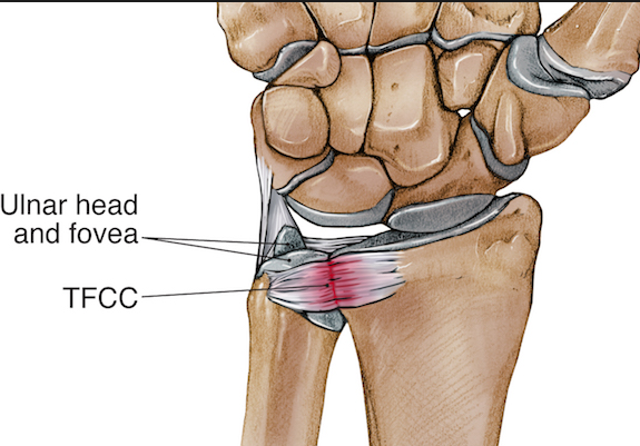  TFCC 크로스핏 Injury (재활)_