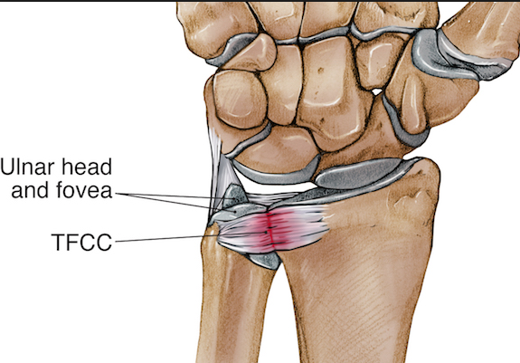 TFCC 크로스핏 Injury (재활)_