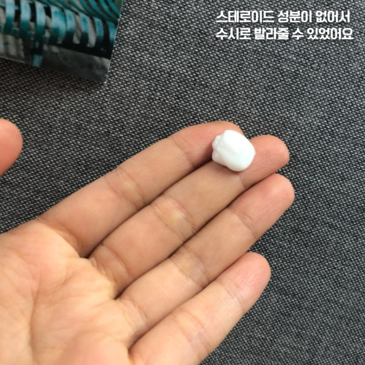  스테로이드 부작용 없이 피부습진 가려움치료!