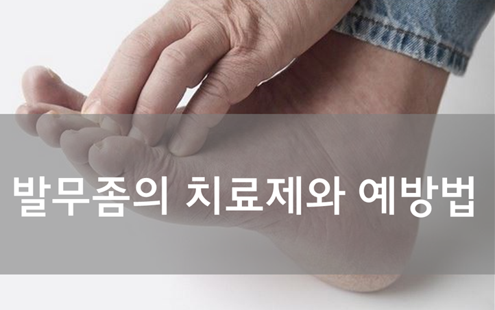 무좀, 약국에서 치료하고 예방하는 법 (재발성 무좀 / 무좀약 / 무좀약추천 / 라미실 / 라미실원스 / 터비뉴겔 / 피엠졸큐 ...