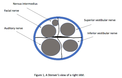 Internal Acoustic Meatus Diagram