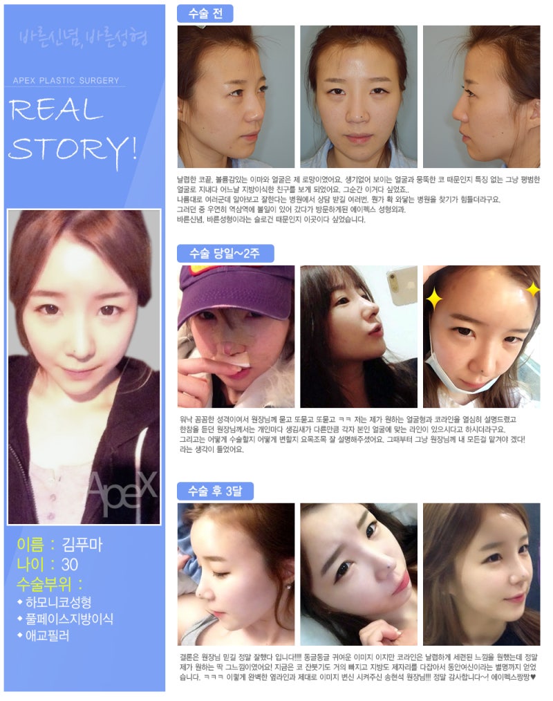 좋은 성형외과를 고르는 방법!