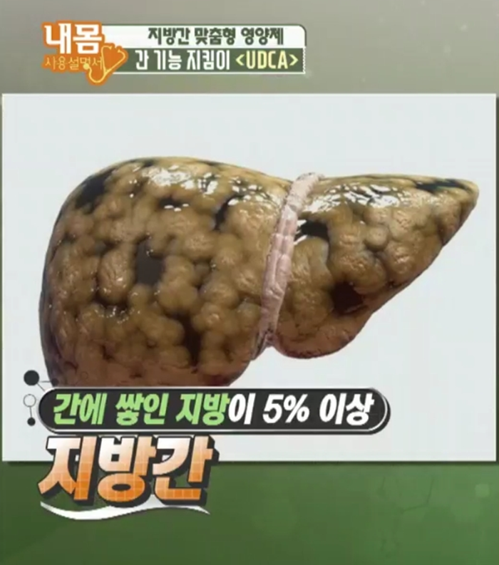  지방간 건강지킴이 (UDCA) 간기능개선 알아보기
