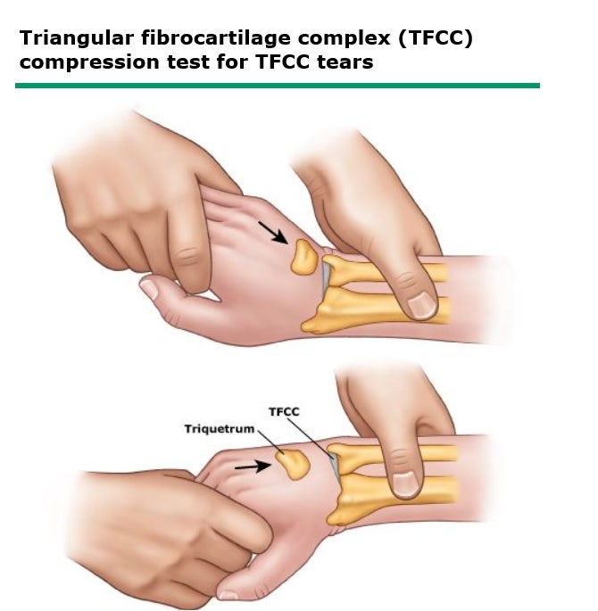 광주 손목통증치료 드퀘르벵 건초염, TFCC : 네이버 블로그