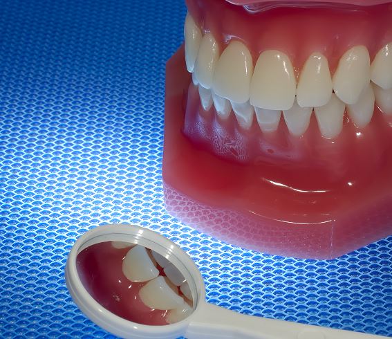 치과의 치아미백 종류는 왜 여러가지 인가요?