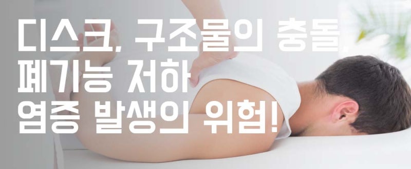 경기광주척추병원 어깨 높이가 다르다! 척추측만증