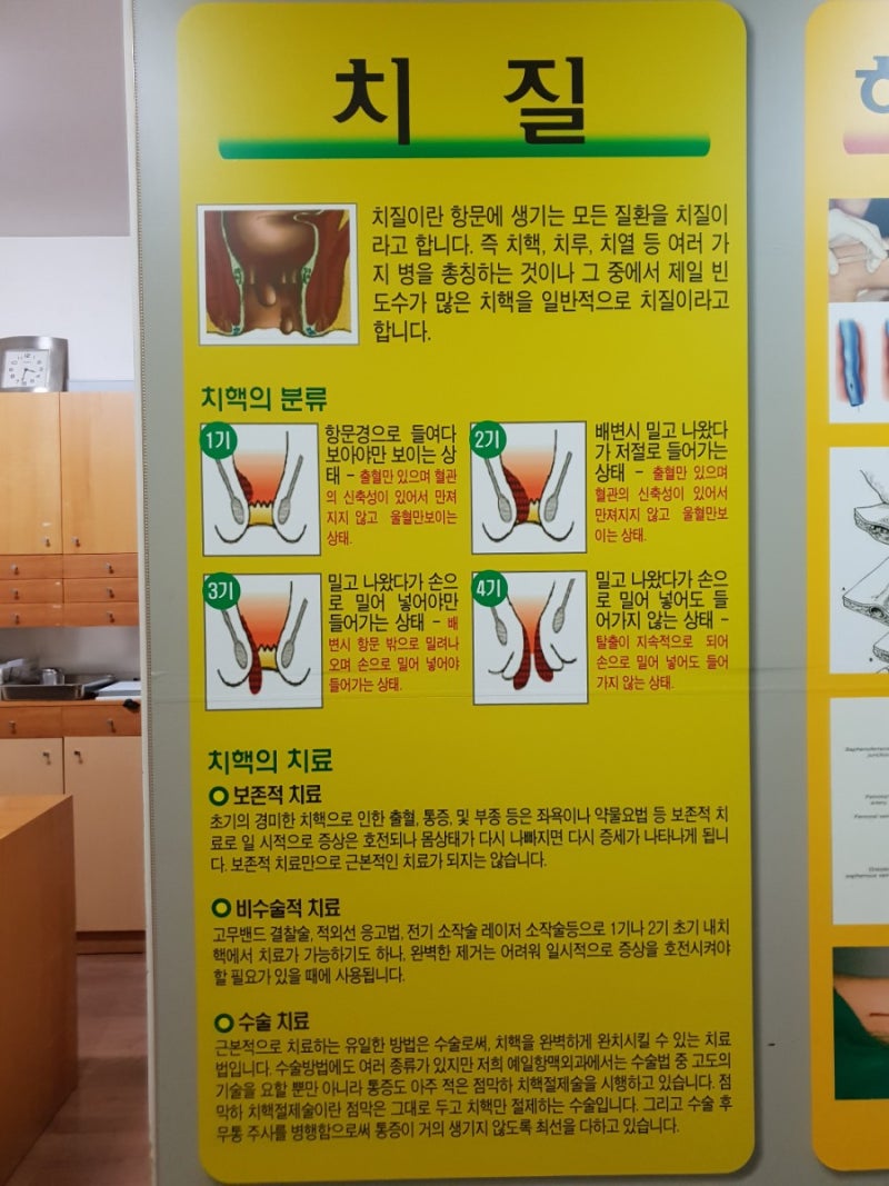 치질수술후기, 통증 무통주사, 수술후 회복방법, 치패드 사용기 창원 마산 병원 : 네이버 블로그