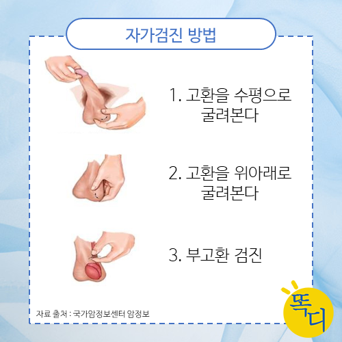 고환암 증상을 관리하는 방법