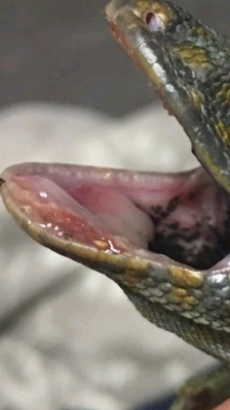 미어캣 물림 응급실 | TikTok, image size:800x1422