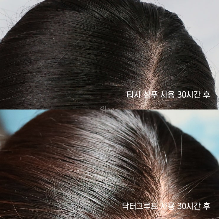  두피관리 첫걸음 닥터그루트 탈모증상완화 샴푸 쓰며 실천 중