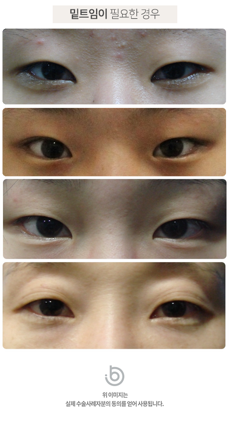 눈꼬리를 치켜올린 눈꺼풀을 생생하게 3