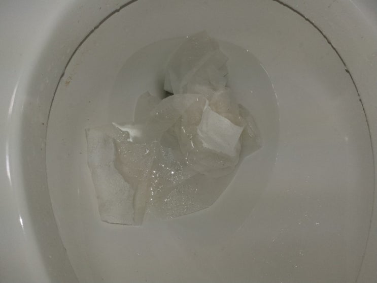  아무도 모르던 변기 막힘 원인, 석션으로 밝혀냈습니다!