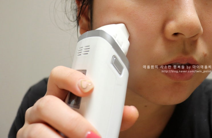  유난희홈쇼핑 가정용IPL 할만한데?스킨테크놀로지 IPL-10000