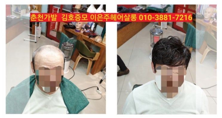 춘천가발 김호증모 남자맞춤가발 피팅합니다~^^
