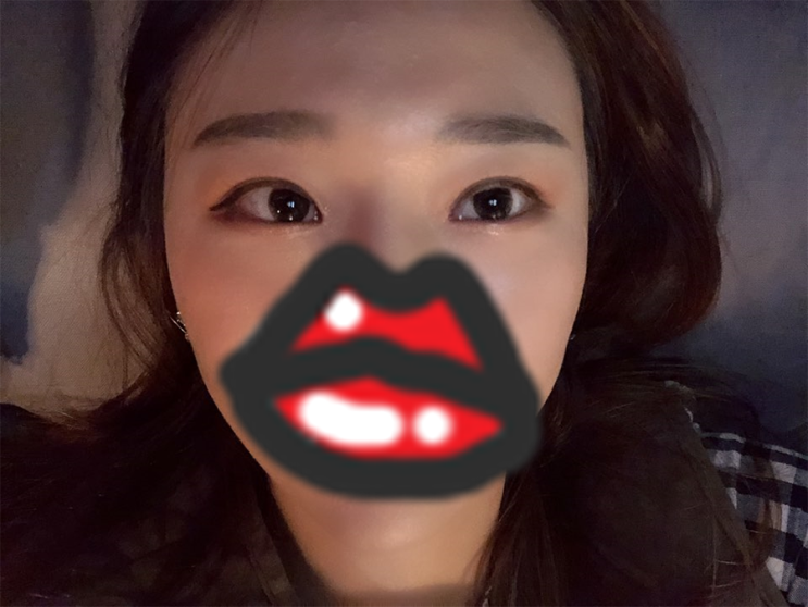  눈밑꺼짐필러,눈밑보톡스 효과 본 피부홈케어 리얼후기(광고x)