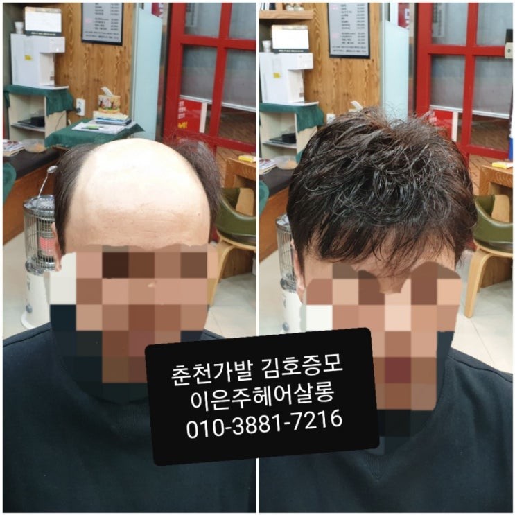  춘천가발 김호증모 남자맞춤가발 이은주헤어살롱