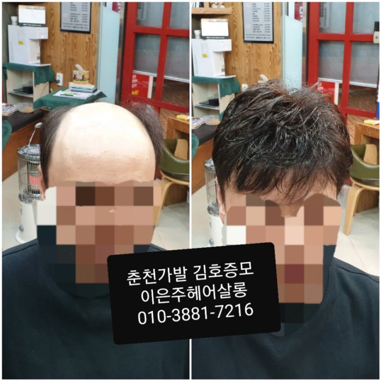 춘천가발 김호증모 남자맞춤가발 이은주헤어살롱