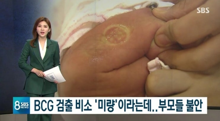  비소 부작용 BCG 경피용 / 피내용 로트번호 확인하세요!