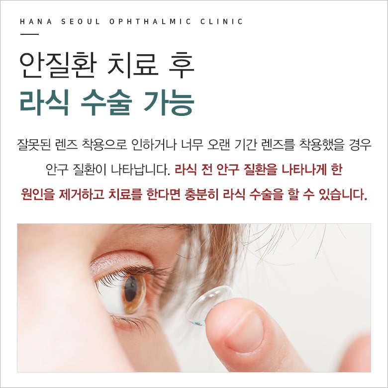 라식수술 전 렌즈 착용에 관한 궁금증 : 네이버 블로그 라식수술 전 렌즈 착용에 관한 궁금증 : 네이버 블로그