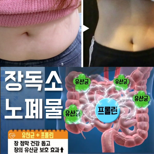  프리바이오틱스추천 프롤린유산균 뚱보균-5kg