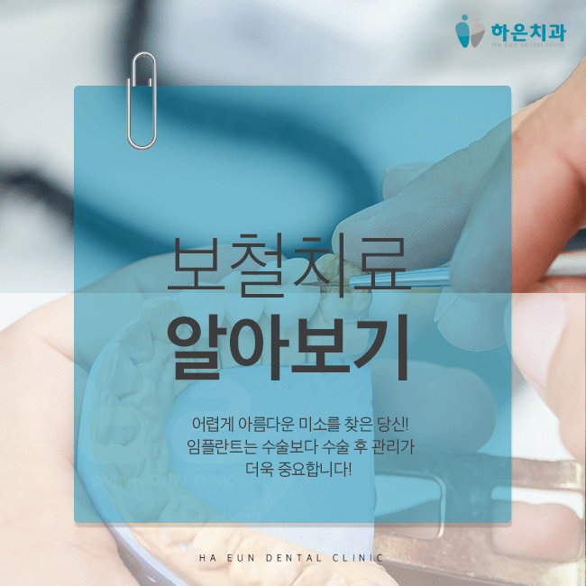 양산석산치과 보철치료 상식! 양산석산치과 보철치료 상식!