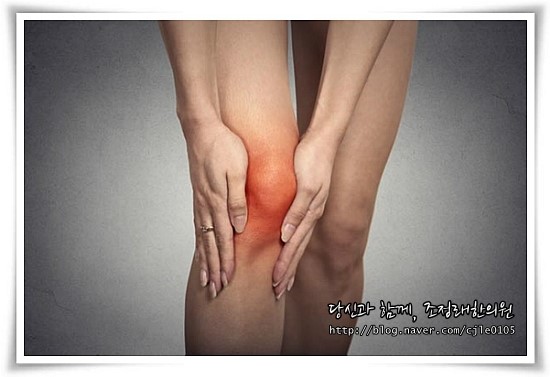  내부의 적 자가면역질환 - 천의 얼굴을 가진 질병, 루푸스병(루푸스)과 보약(補藥)  2