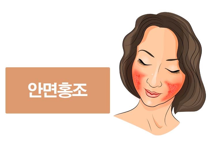 ●얼굴홍조원인, 피부열감, 울긋불긋 극복
