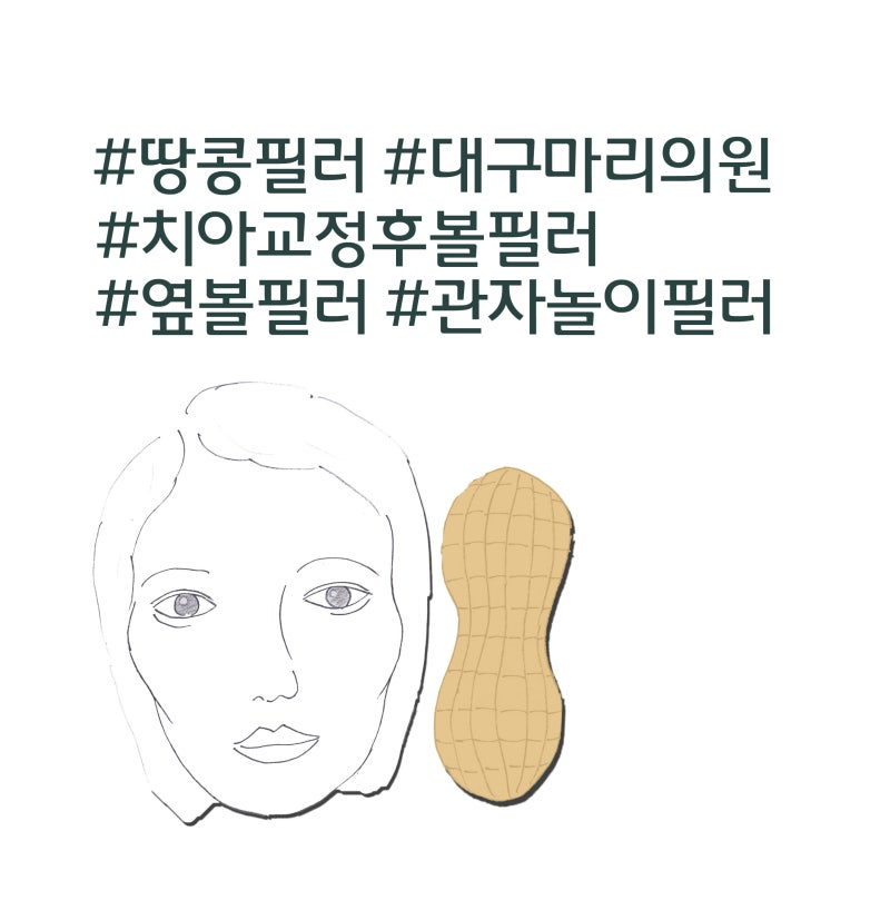 치아교정 땅콩 필러]옆볼필러, 관자놀이 필러, 치아교정 후 관자, 대구볼꺼짐필러, 대구마리의원 : 네이버 블로그