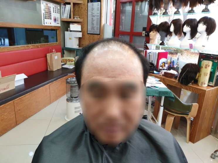  춘천가발 김호증모 남자맞춤가발 본뜨기^
