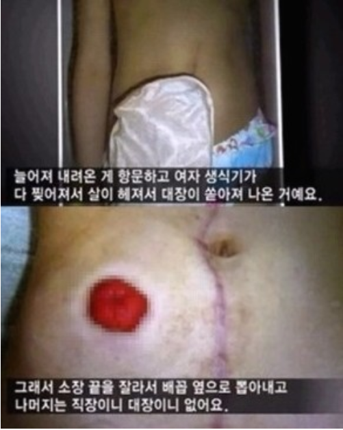  조두순 여아 성폭행 사건
