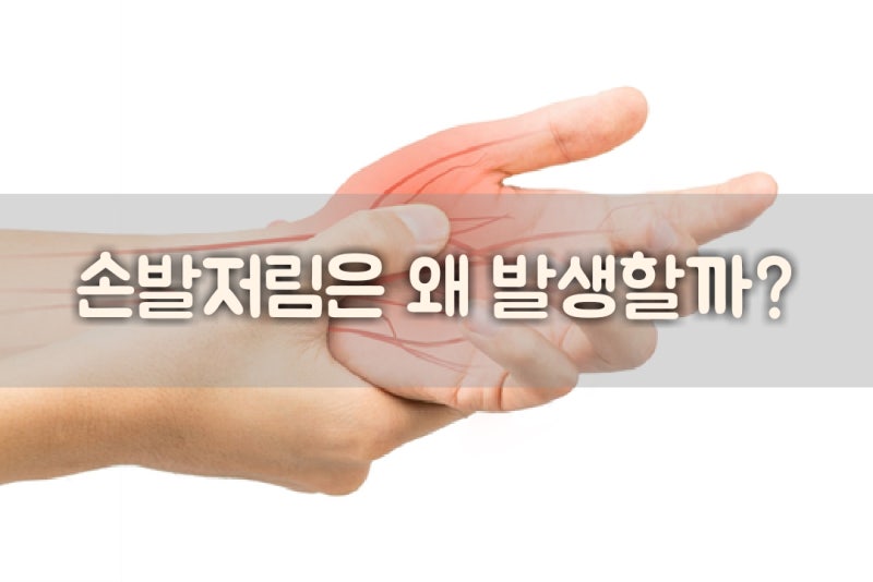 →온체 고주파자극기 손발 저림에 좋습니다! 상담 가능!