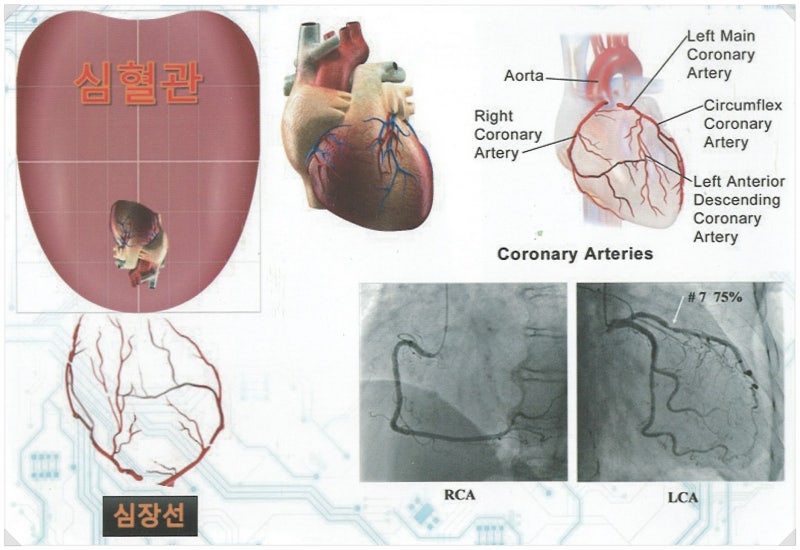 명쾌한 설진 이야기> 알콜성 간경화 초진환자 2명 설진패턴 분석 (사진 역하신 분 패스) : 네이버 블로그