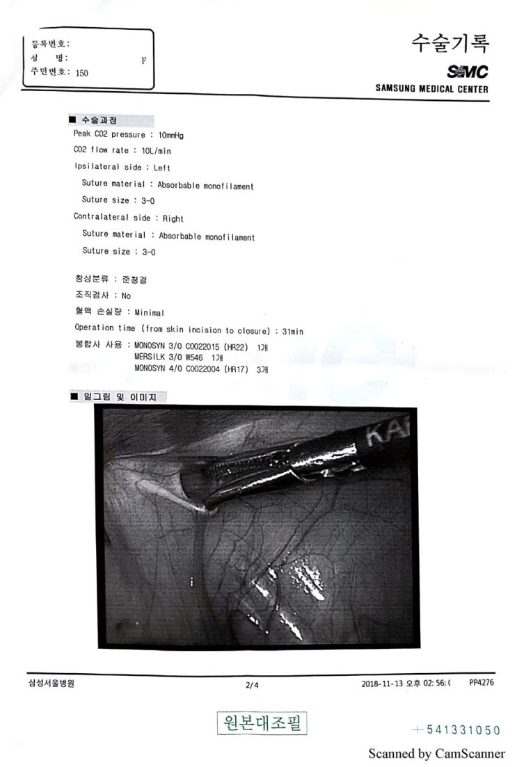  탈장수술 태아보험 청구사례