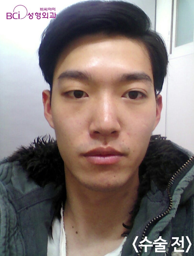 남자 짝눈 부드러운 인상으로 변신! : 네이버 블로그 남자 짝눈 부드러운 인상으로 변신! : 네이버 블로그
