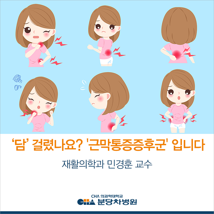  ‘담’걸리셨나요? '근막통증증후군'입니다 -재활의학과 민경훈 교수