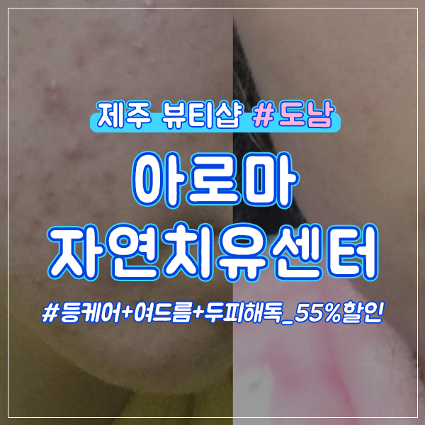  제주시 도남 여드름&아토피 케어 도민할인정보!