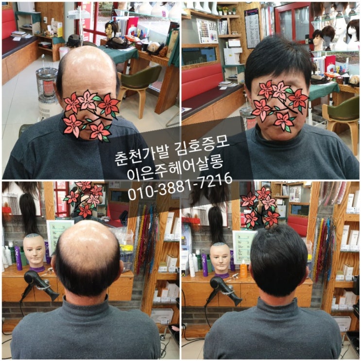  춘천가발 김호증모 기성가발 착한가격 당일가발~^^