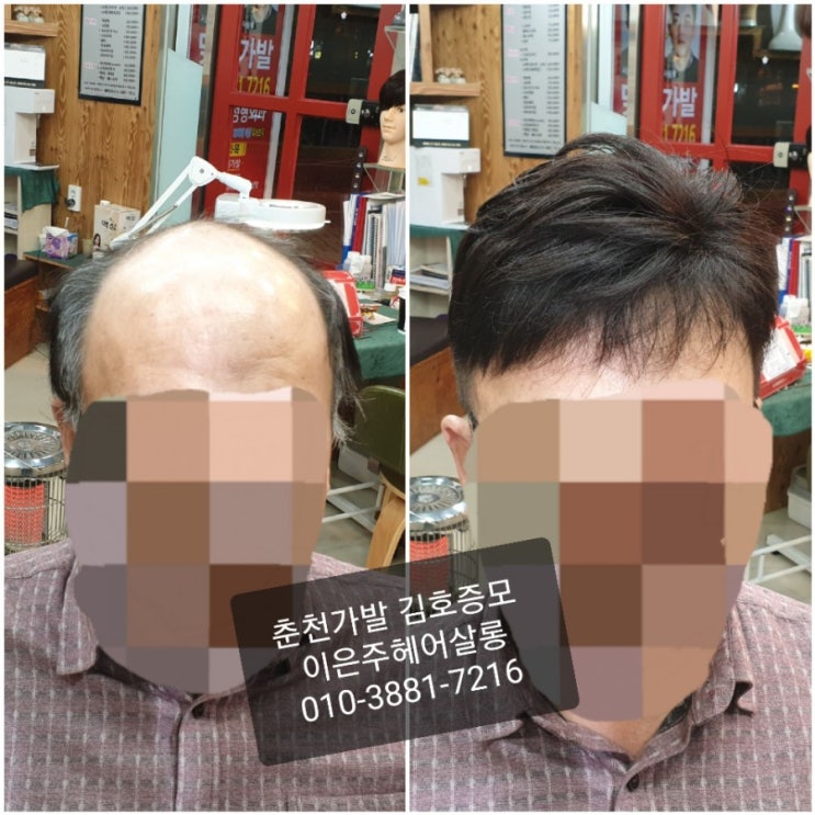  춘천가발 김호증모 남자맞춤가발 관리받는 날~